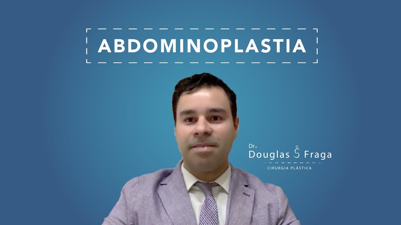 Douglas Severo Fraga-11