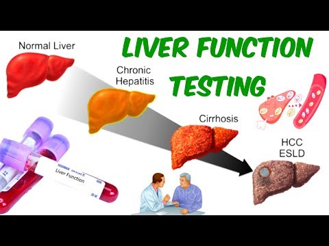 download lagu mp3 mp4 Liver Function Test Cost, download lagu Liver Function Test Cost gratis, unduh video klip Liver Function Test Cost