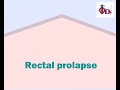 Rectal Prolapse Dr Tulip JP Nagar
