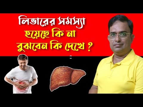 Signs And Symptoms Of Liver Disease. লিভারের সমস্যার প্রাথমিক লক্ষণ গুলো কি কি ? HealthCription