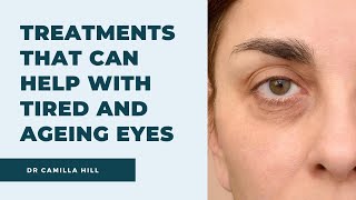 Treatments can help with tired and ageing eyes | Dr Camilla Hill