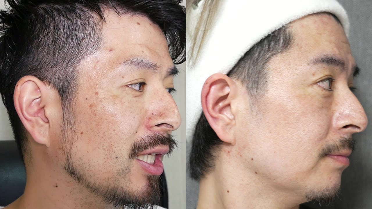 【驚愕】メンズ美容歴４年で肌キレイになりすぎな件