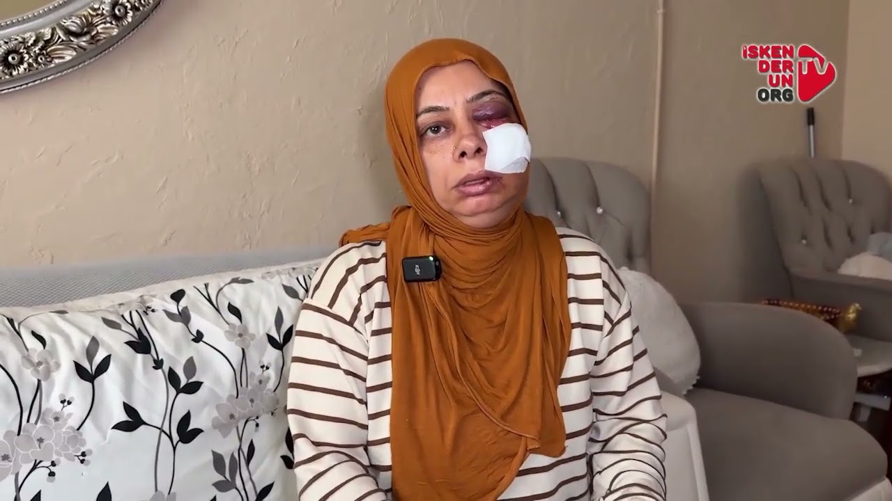 Açık Su Kanalına Düşen Genç Kadın Yaralandı