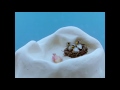 Final Pingu
