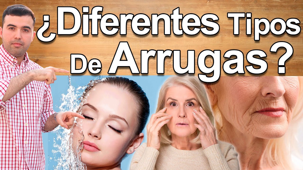 4 Tipos de Arrugas y Cómo Eliminarlas - Cómo Eliminar Las Arrugas Naturalmente - Ojos, Cara Belleza