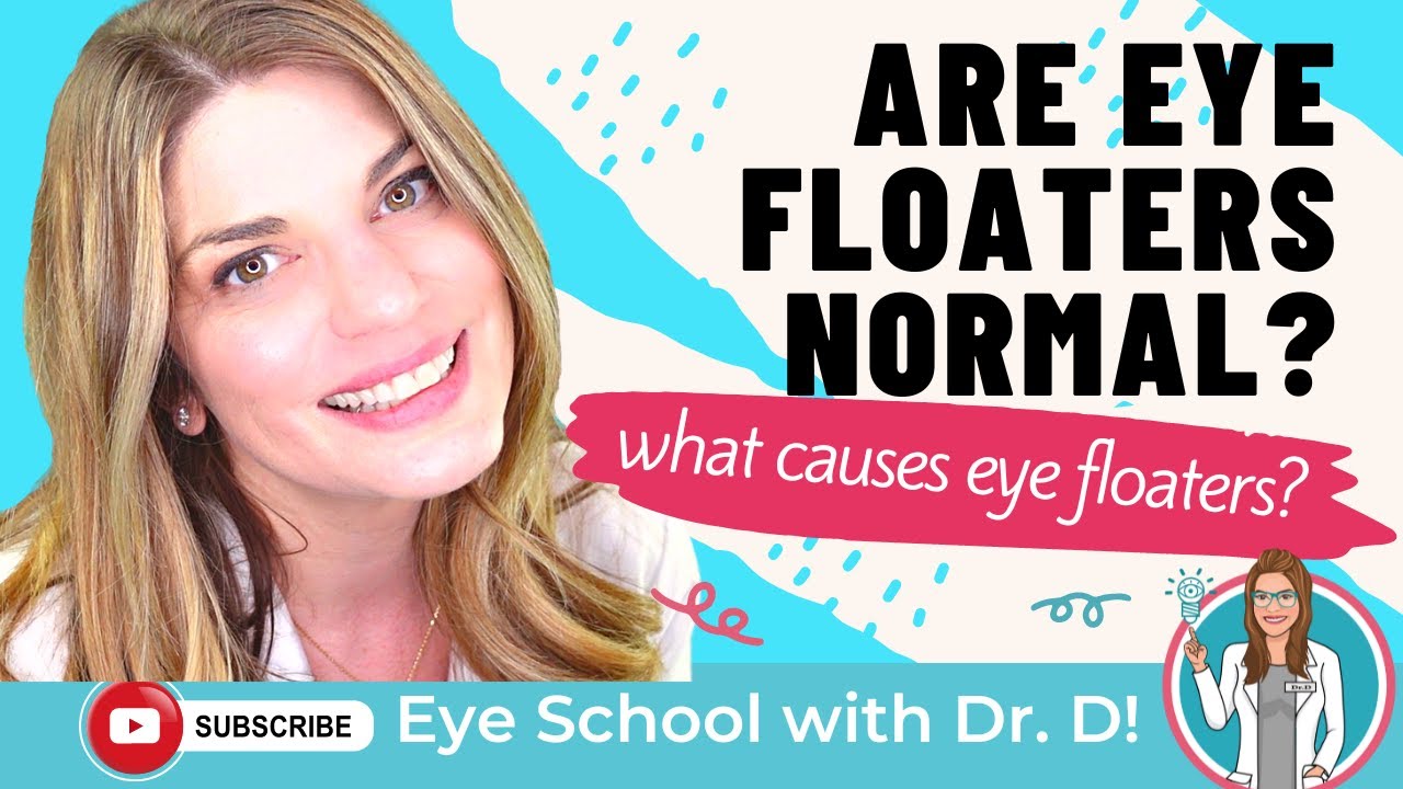 Do You Have Eye Floaters? | Are Eye Floaters Normal? | An Eye Doctor Explains