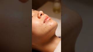 Under Lip Blackhead Clean | Ultra Realistic ASMR Extraction | #asmr #realisticasmr #asmrsounds