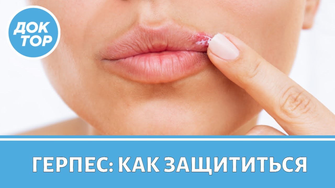 Когда герпес становится реальной угрозой жизни