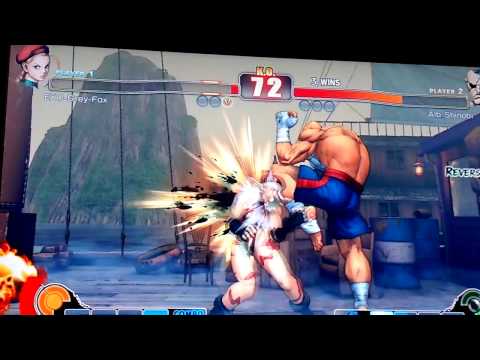 AlboShinobi (Sagat) Vs Exo-Grey-Fox (Cammy)