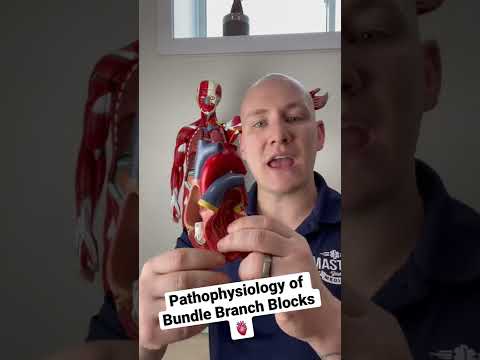 Pathophysiology of bundle branch blocks #paramedic #paramedicstudent #emtstudent #nremt
