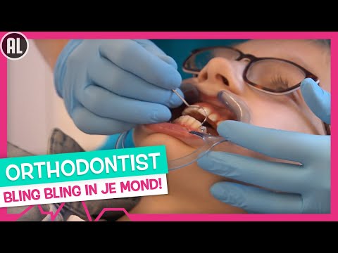 BEUGEL ERIN 😬 EN ERUIT!😁 - TOPDOKS SPECIALISME