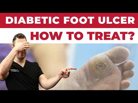 Heel Spurs Plantar Fasciitis BEST Home Treatment 2022