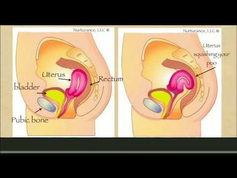 download Cara Cepat Hamil Untuk Rahim Tinggi, download video viral Cara Cepat Hamil Untuk Rahim Tinggi gratis, unduh video klip Cara Cepat Hamil Untuk Rahim Tinggi