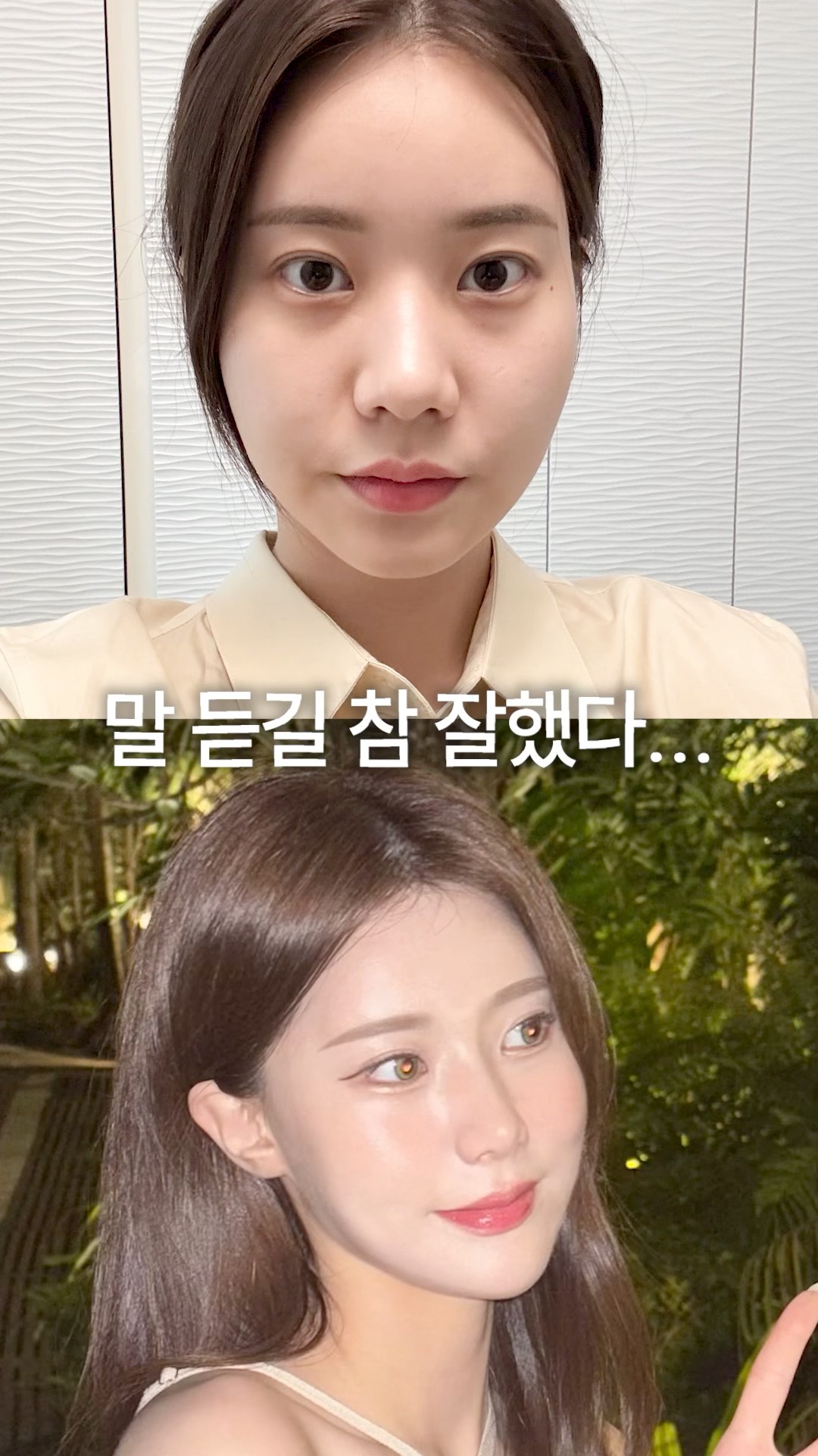 몰라서 효과 못보는 시술