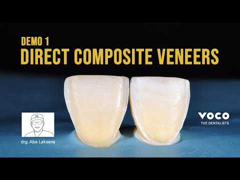 Step by Step - Direct Composite Veneers Restoration with 2 Layers Technique