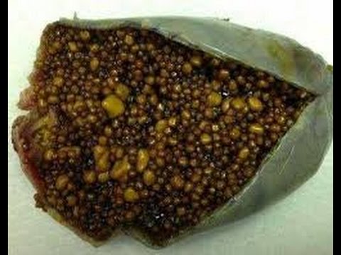 กลากผลกระทบในเด็ก ครีมสำหรับโรคสะเก็ดเงินในร่างกาย