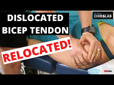 Dislocated Bicep Tendon Relocation AND Aftercare Tips