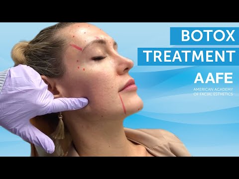 Botox Treatment | AAFE