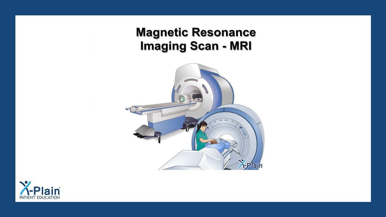 Magnetic Resonance Imaging Scan - MRI