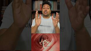 how hookworms enter the body?
