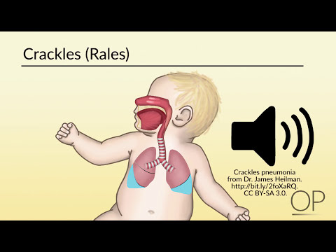 Respiratory Assessment by B. Leary, L. DelSignore | OPENPediatrics
