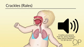 "Respiratory Assessment" by Brienne Leary for OPENPediatrics