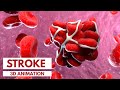 Understanding The Different Types Of Stroke 3D Animation