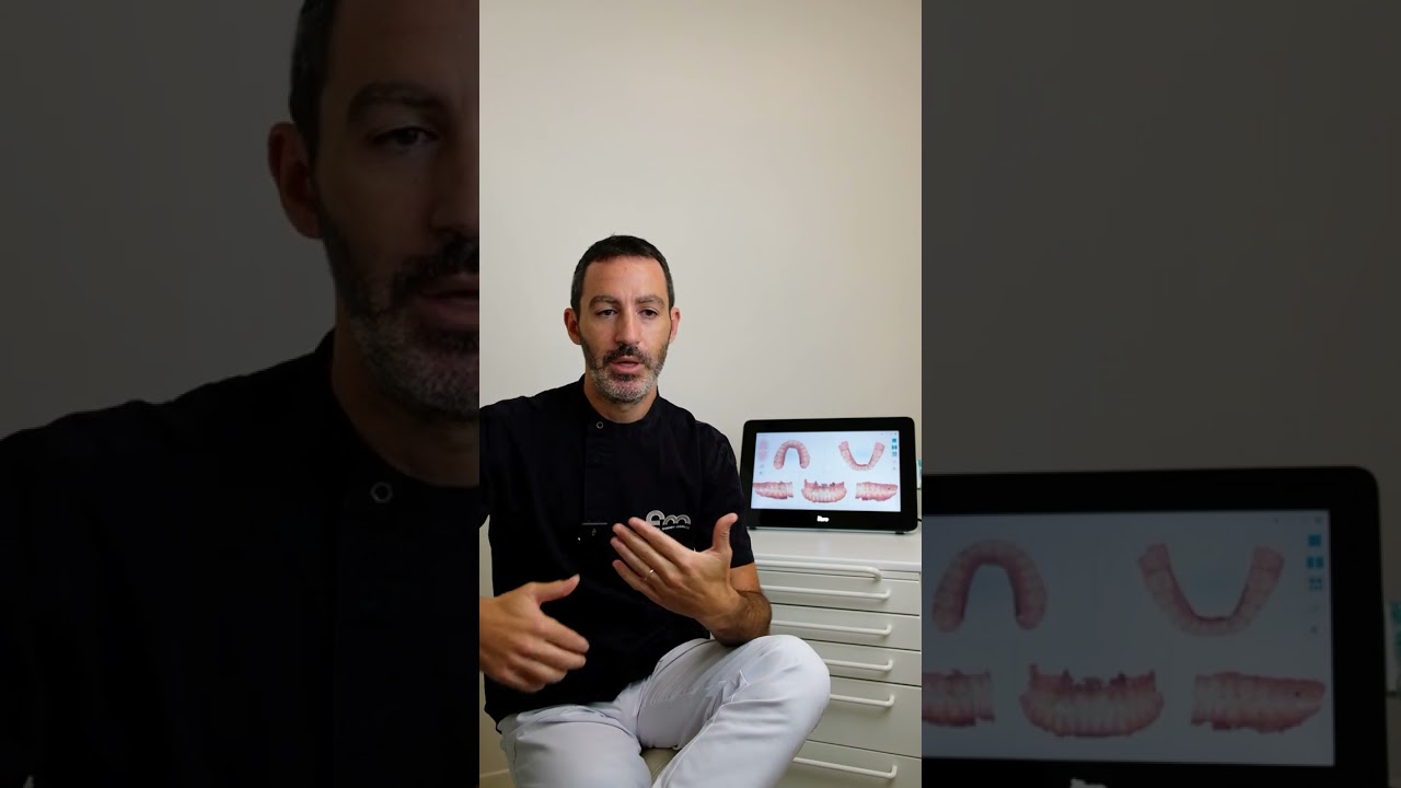 Ortodonzia con Invisaling e faccette