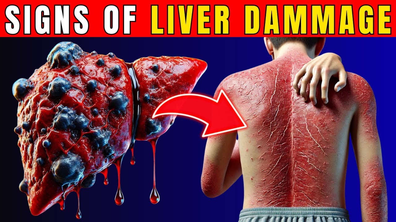 11 Strange Signs of LIVER DAMAGE| Healthy Care