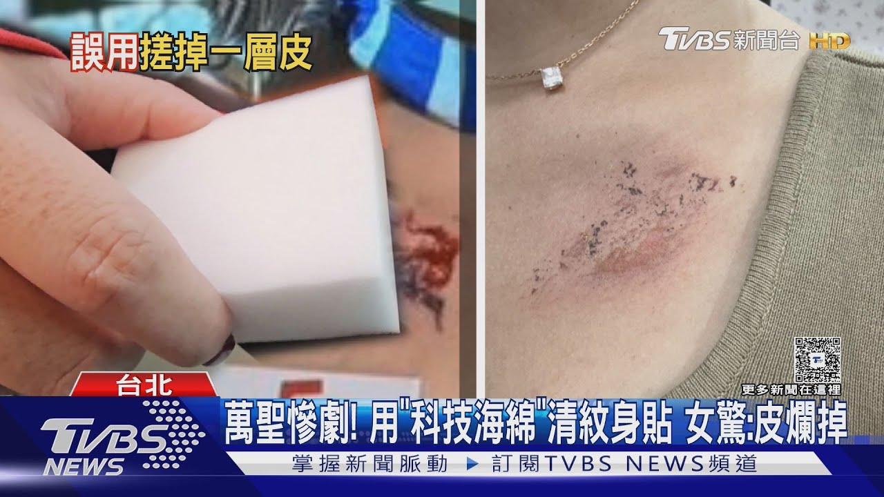 萬聖慘劇! 用「科技海綿」清紋身貼 女驚:皮爛掉