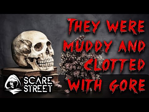 Berenice by Edgar Allan Poe | Short Horror Stories