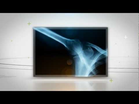 Hip Behandlung keine Verknöcherung Wundes Gelenk des Mittelfingers der linken Hand Behandlung