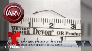Sufría de dolor insoportable de garganta por este motivo | Al Rojo Vivo