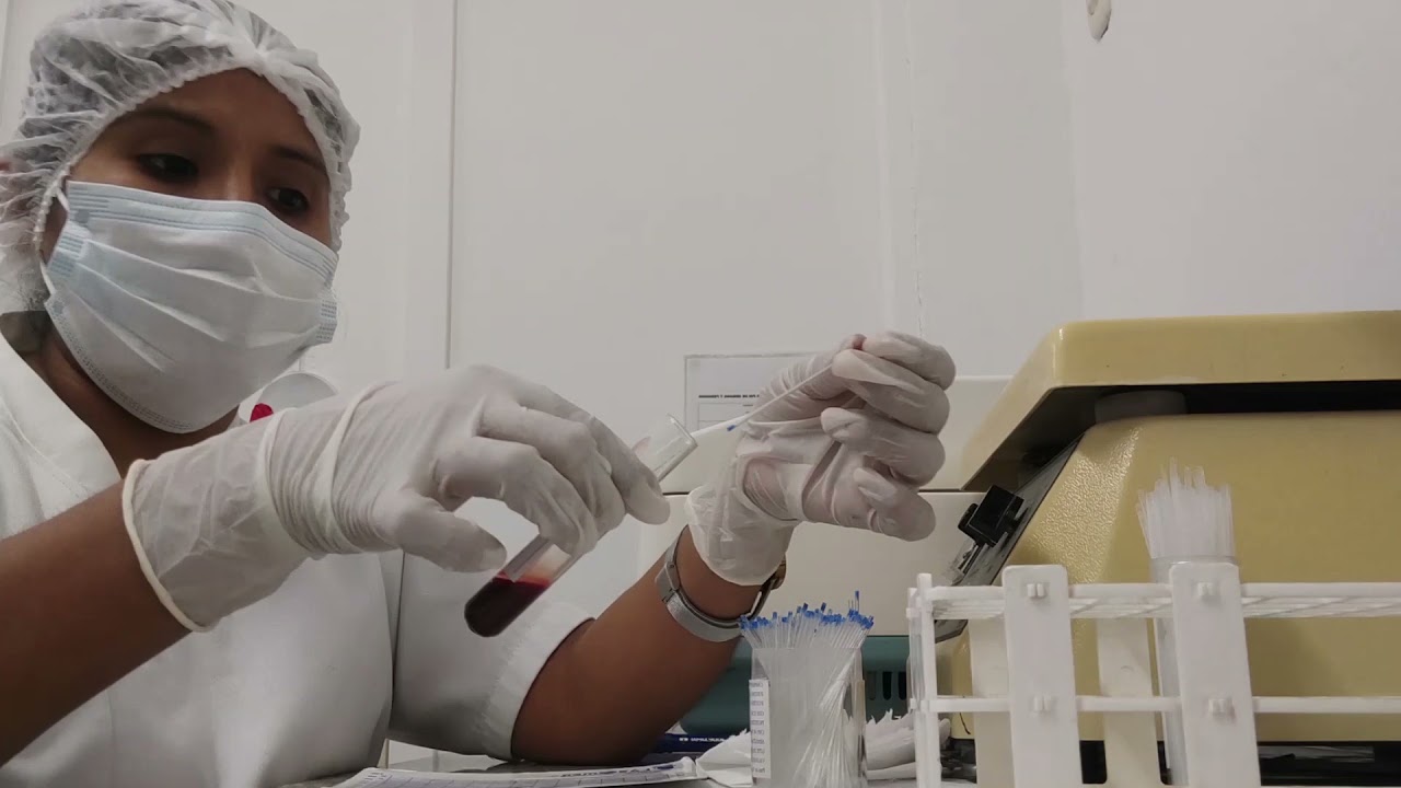 determinación de hematocrito