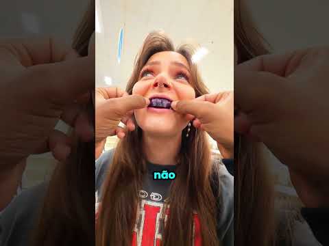 PARECIA ALGO SIMPLES ATÉ O FINAL 😳 #dentes #shorts