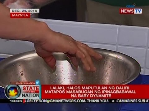 Makakatulong sa mapupuksa ng kuko halamang-singaw sa iyong mga kamay Selisilik unguento ng halamang-singaw sa kanyang mga paa