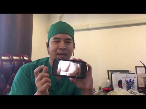 เพิ่ม myostimulation เต้านม วิธีการเรียกคืนหน้าอกหลังจากพลาสติก