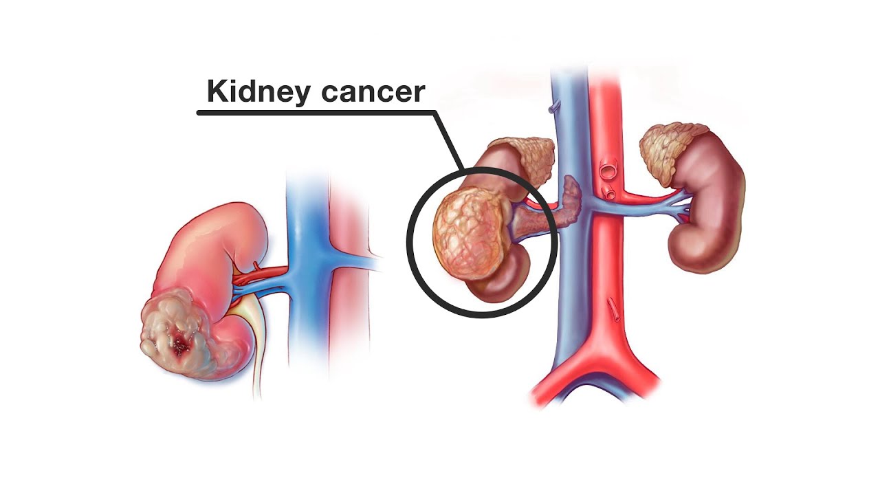 Alejandro Garza Martinez-72