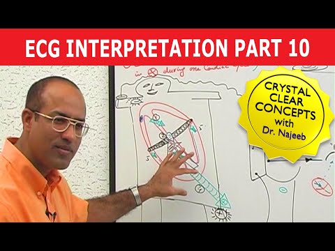 EKG or ECG Interpretation | Part 10/20