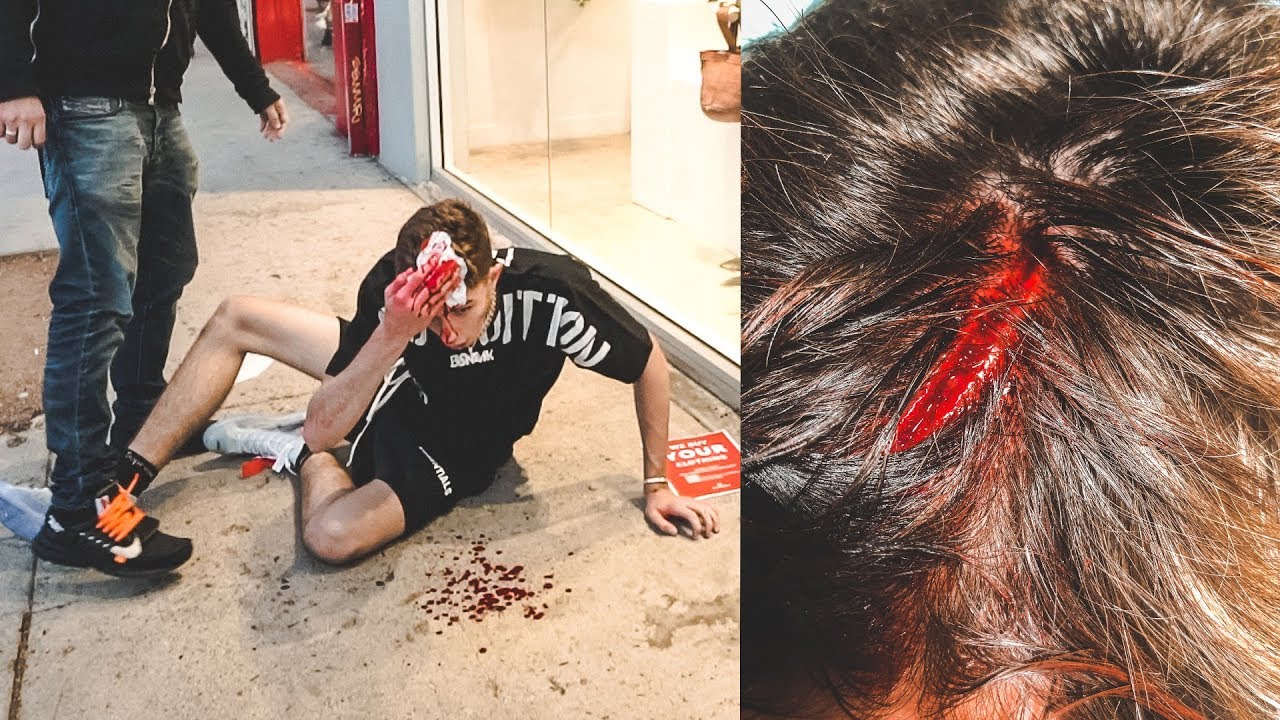 Putar video I Crashed A Supreme Bike and Went to the Emergency Room sekarang I Crashed A Supreme Bike and Went to the Emergency Room