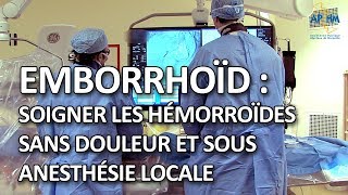 Emborrhoid : soigner les hémorroïdes sans douleur et sous anesthésie locale