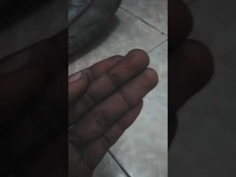 Boyz got no brain- NYAMUK