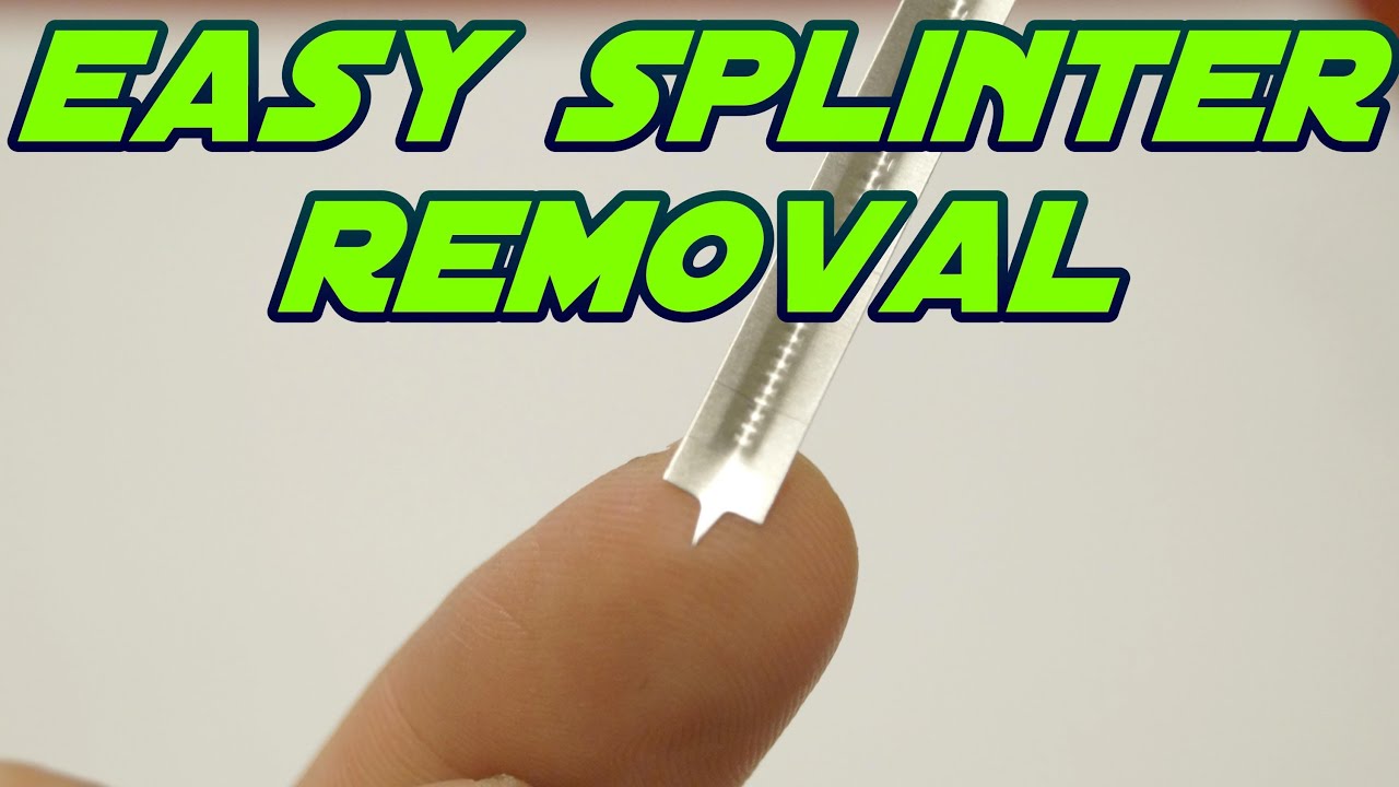 Awesome Splinter Remover - Splinter Out Review and Demo