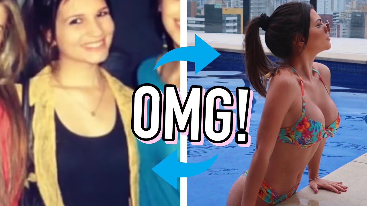 Meu antes e depois do SILICONE 350ml super alto | tirando dúvidas de vocês