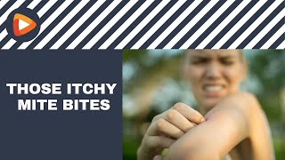 Are Itchy Mite Bites Bugging You? Watch This.