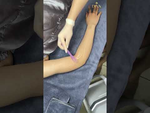 Face Hair Removal in Poipet