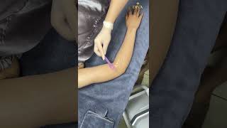 Arm Hair Removal in Poipet