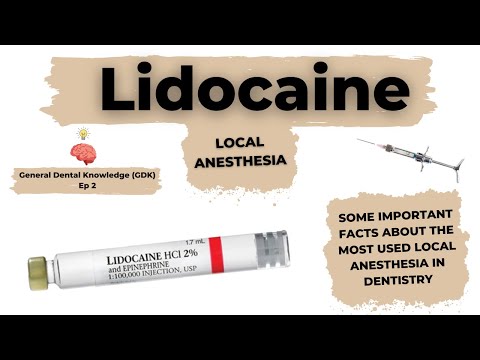 The Lidocaine local anesthetic