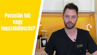 Porcelán héj vagy fogszabályozás? A fogorvos válaszol