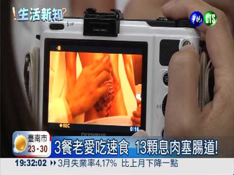 天天鹽酥雞! 31歲粉領族罹大腸癌